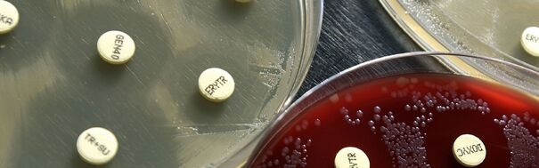Diatabs Identification of bacteria and fungi rapid tests