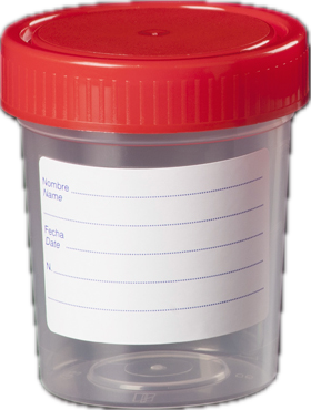 Ουροσυλλέκτες