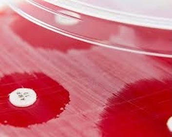 Biomaxima Susceptibility Control Discs